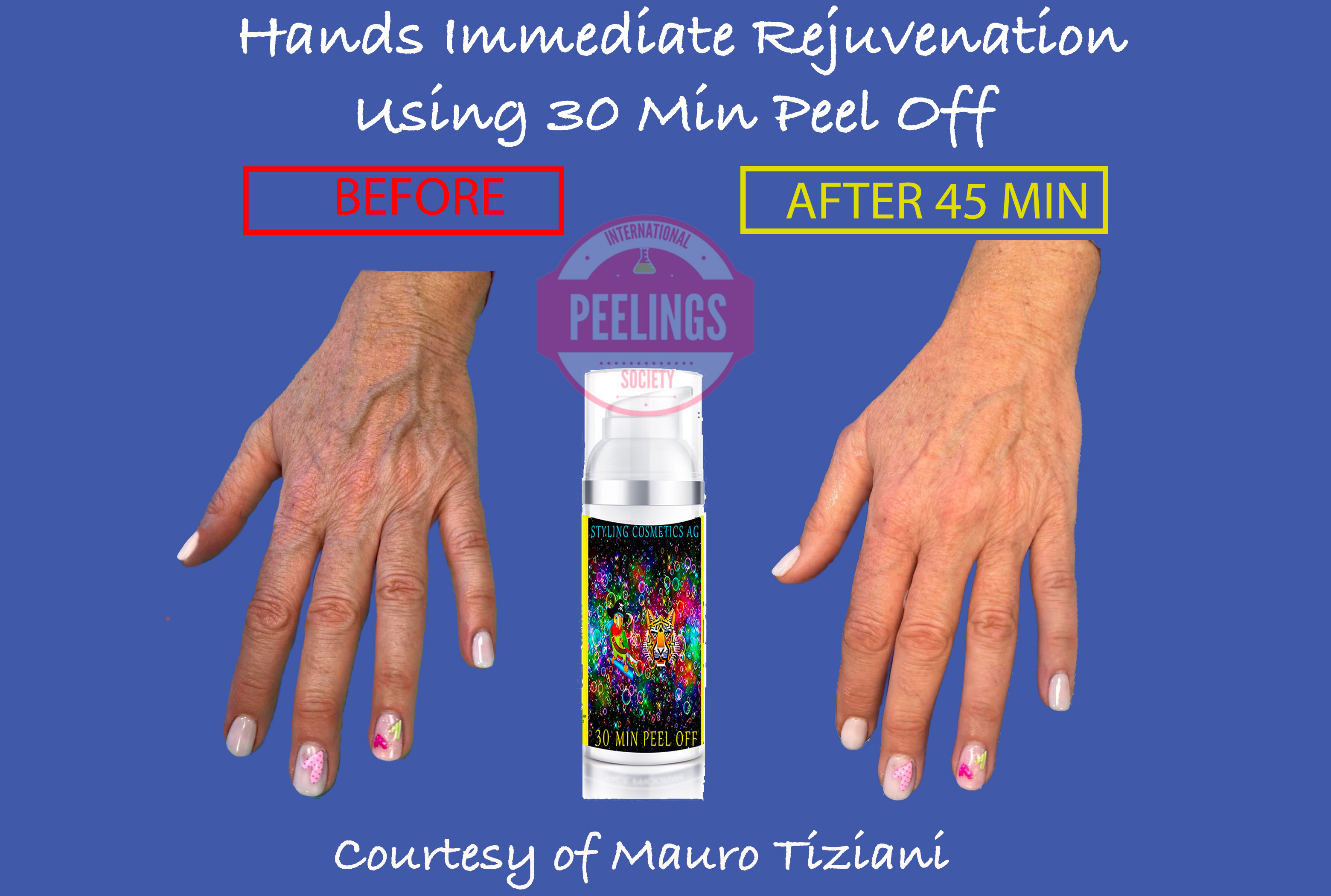 hands-peels